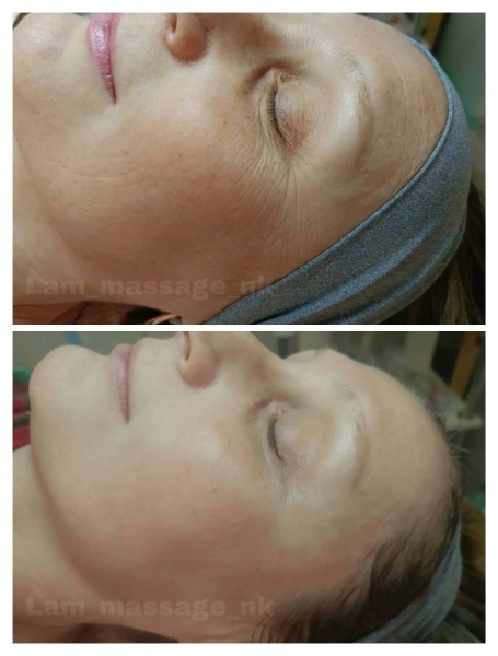 Лифтинг-комплекс Storyderm Ultra Lift Powder, 4 шт